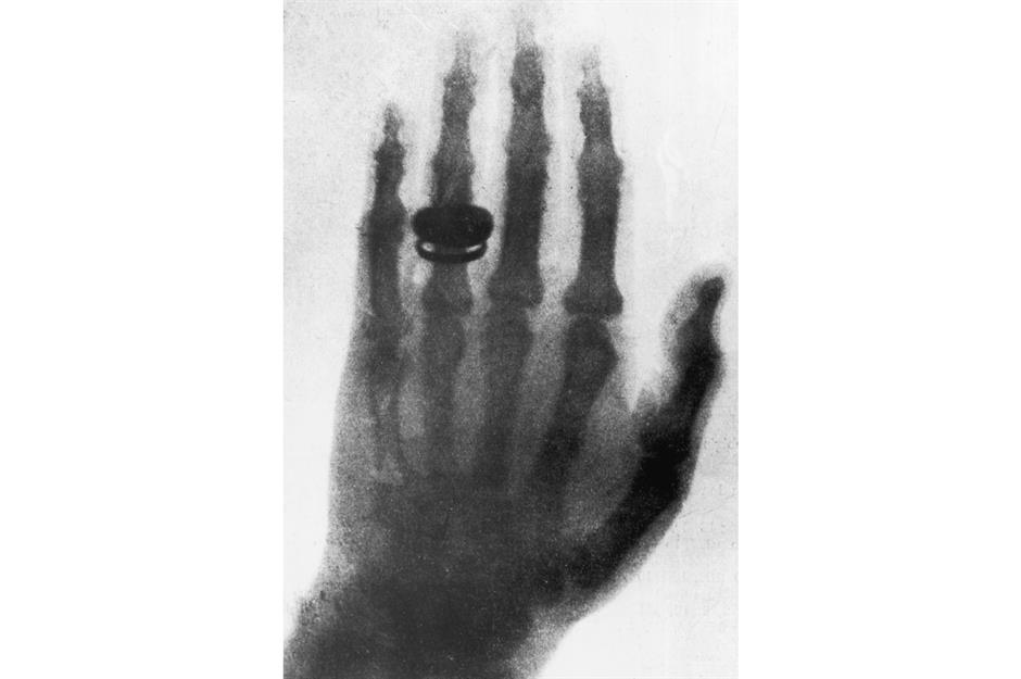 X-rays – 1895
